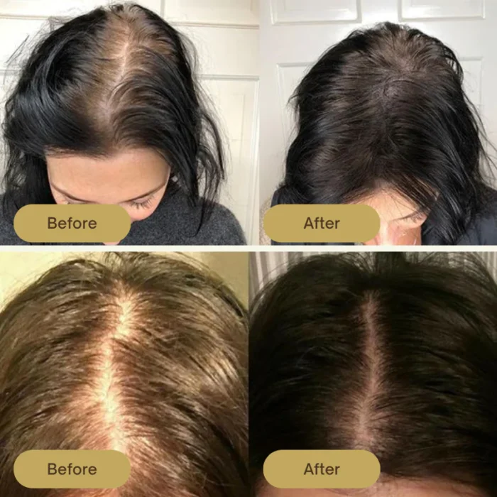 Houdini Vegan Hair Growth Oil - Image 3