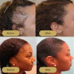 Houdini Vegan Hair Growth Oil - Image 4