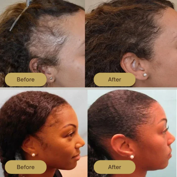 Houdini Vegan Hair Growth Oil - Image 4